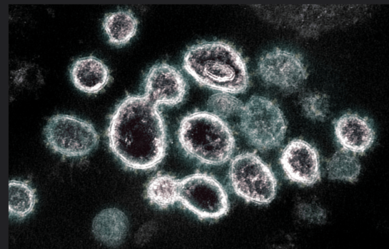 screen-shot-2020-03-27-at-2.04.01-pm-545x349-1